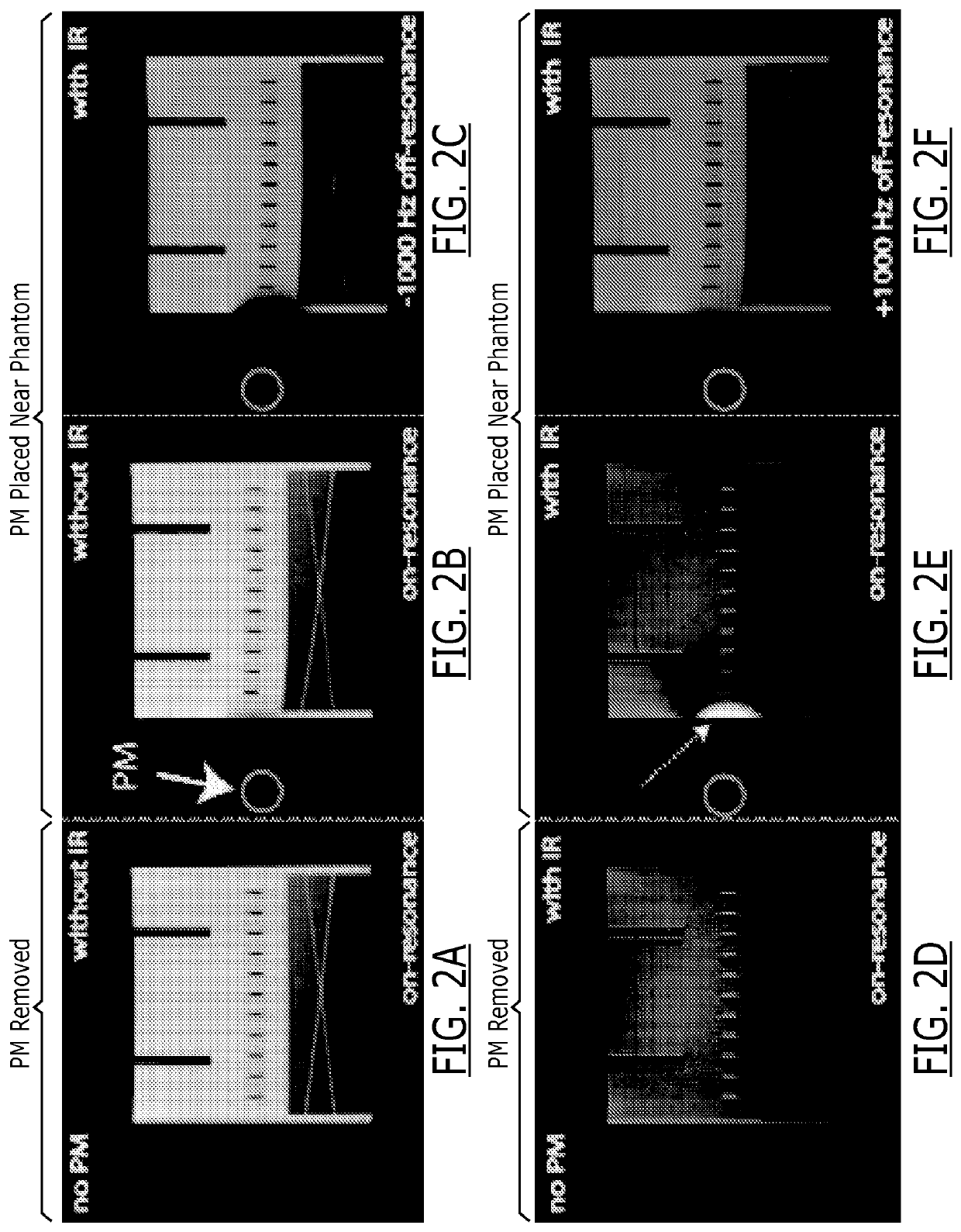 Cardiac late gadolinium enhancement MRI for patients with implanted cardiac devices