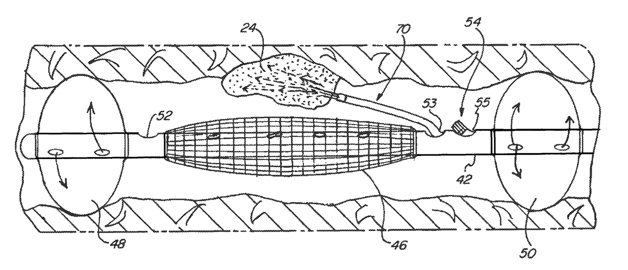 Photodynamic therapy for tumors with localized delivery