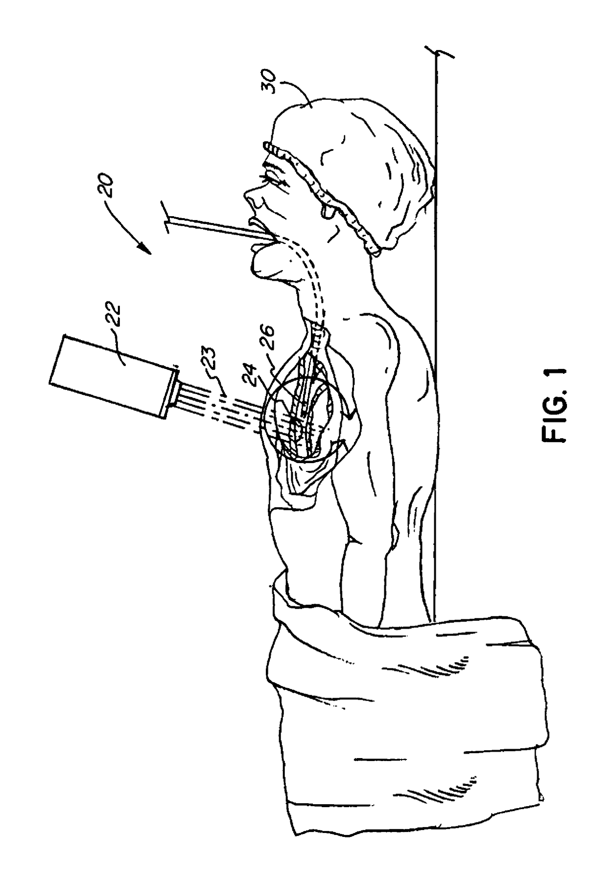 Photodynamic therapy for tumors with localized delivery