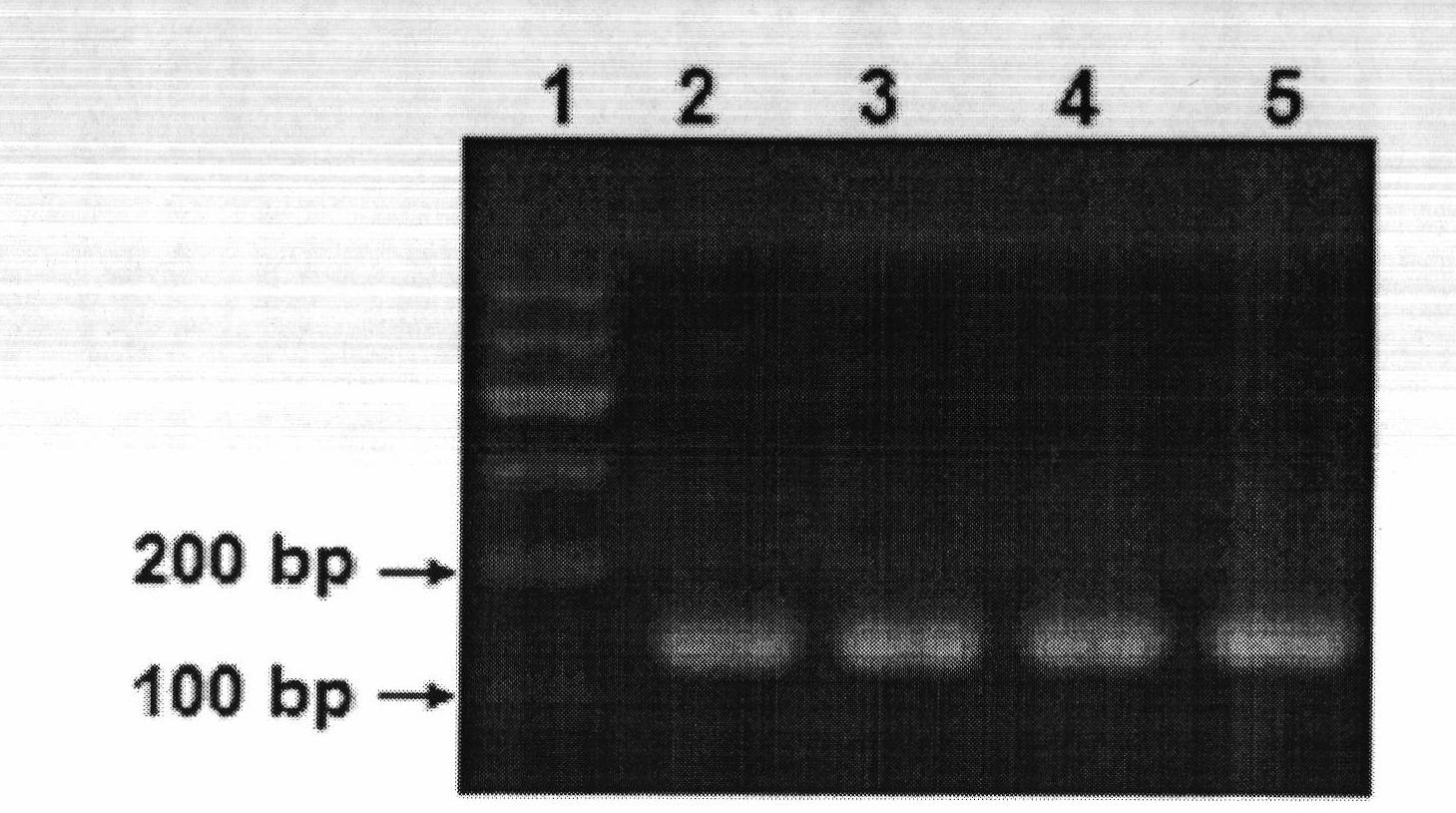 Haemophilus parasuis real-time fluorescent quantitative PCR (polymerase chain reaction) detection method