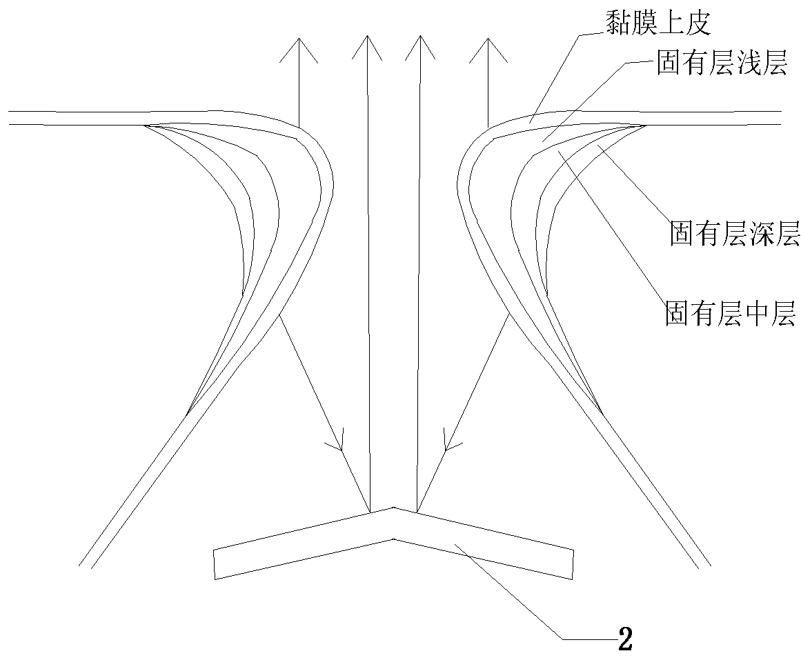 A subglottic mirror device