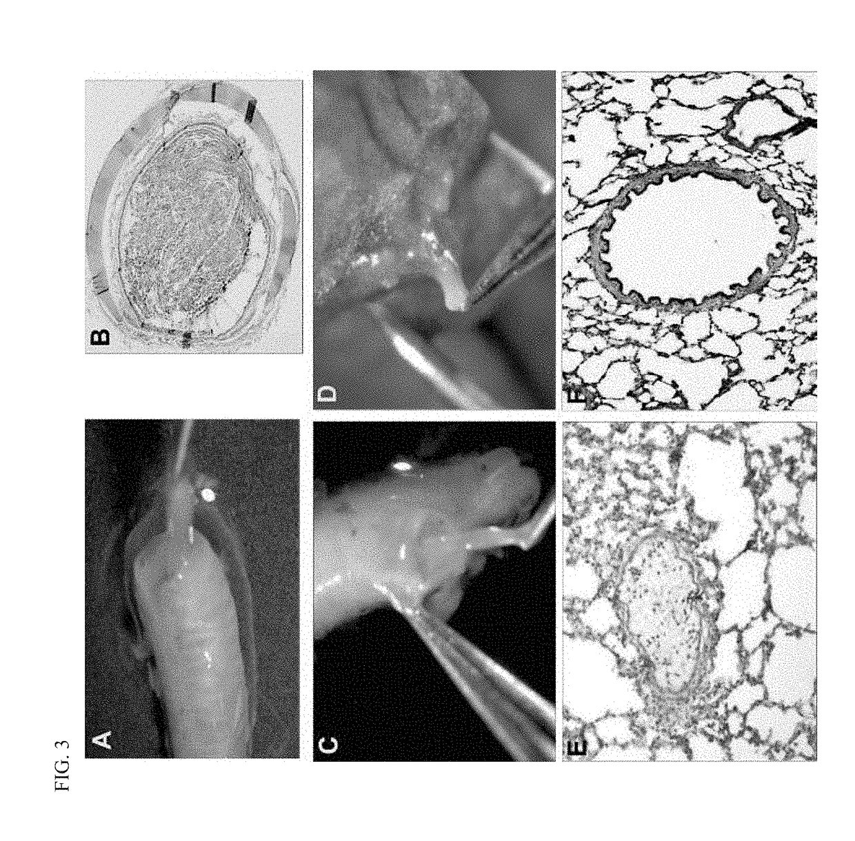 Transgenic animal models for cystic fibrosis