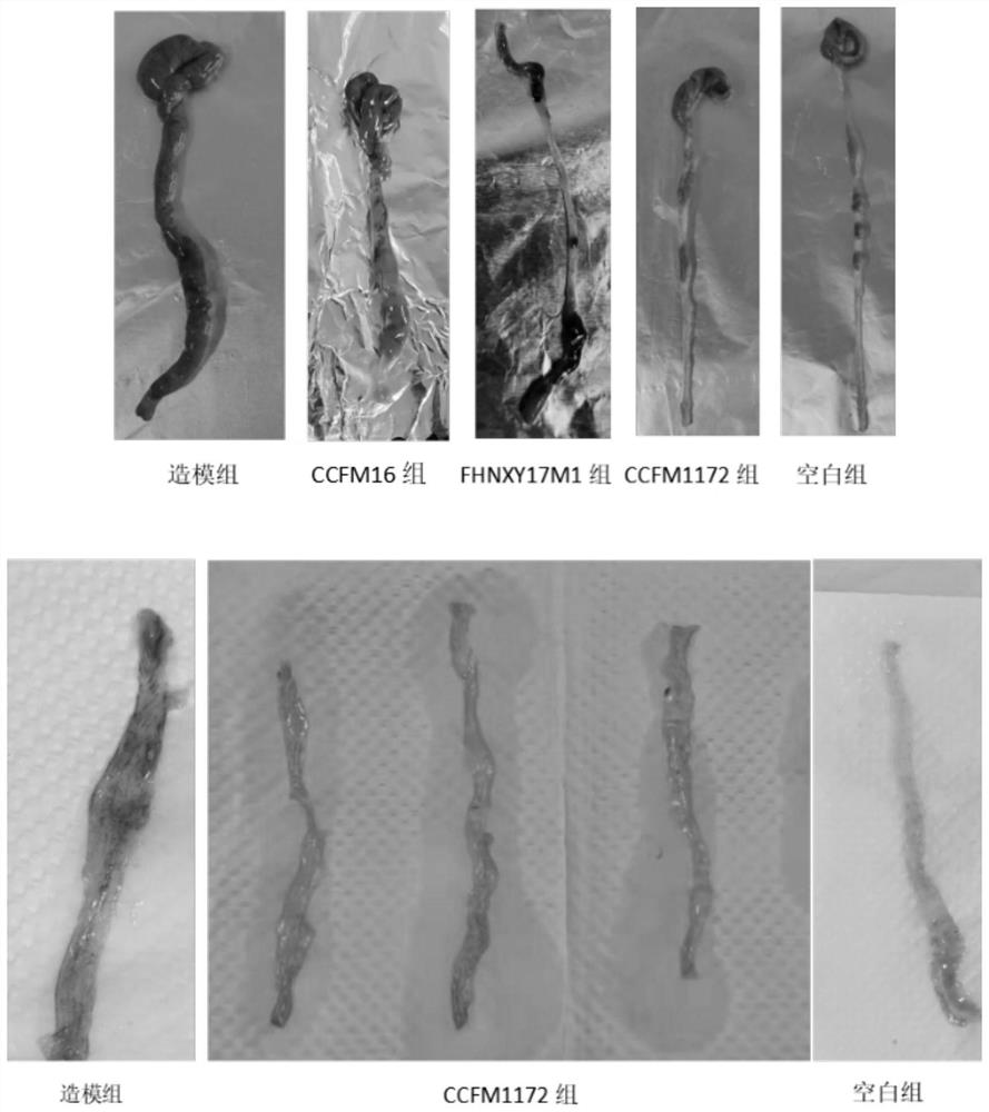 A strain of Bifidobacterium bifidum and its application in relieving intestinal injury