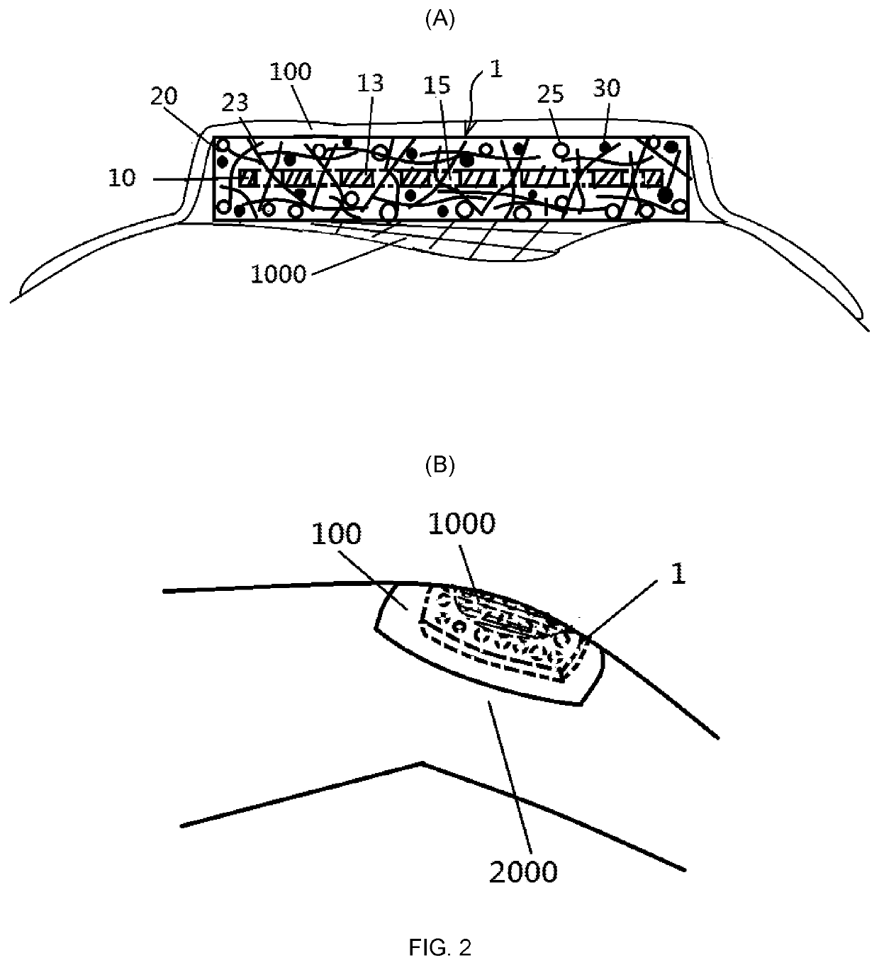 Hydrogel surgical dressing product having a multi-dimensional flexible hydrophilic structure-linkage composite