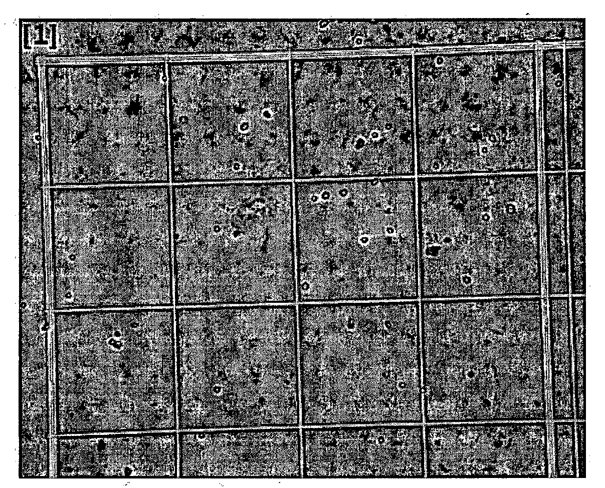 Method for preparing autologous skin cell agent for alleviating or treating skin defects