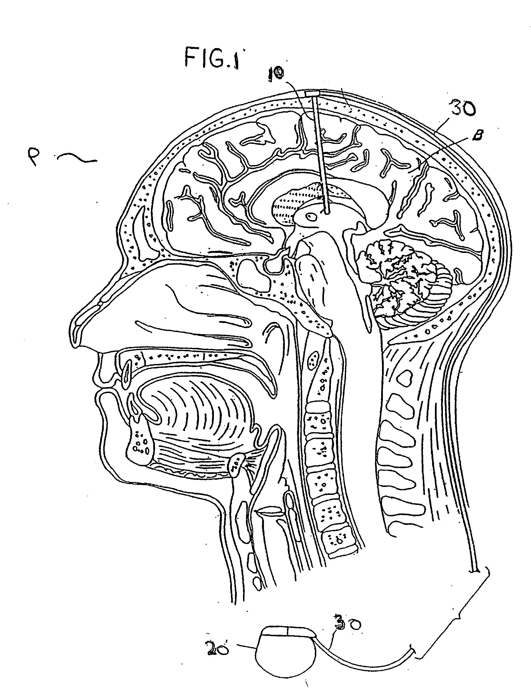 Methods of affecting hypothalamic-related conditions