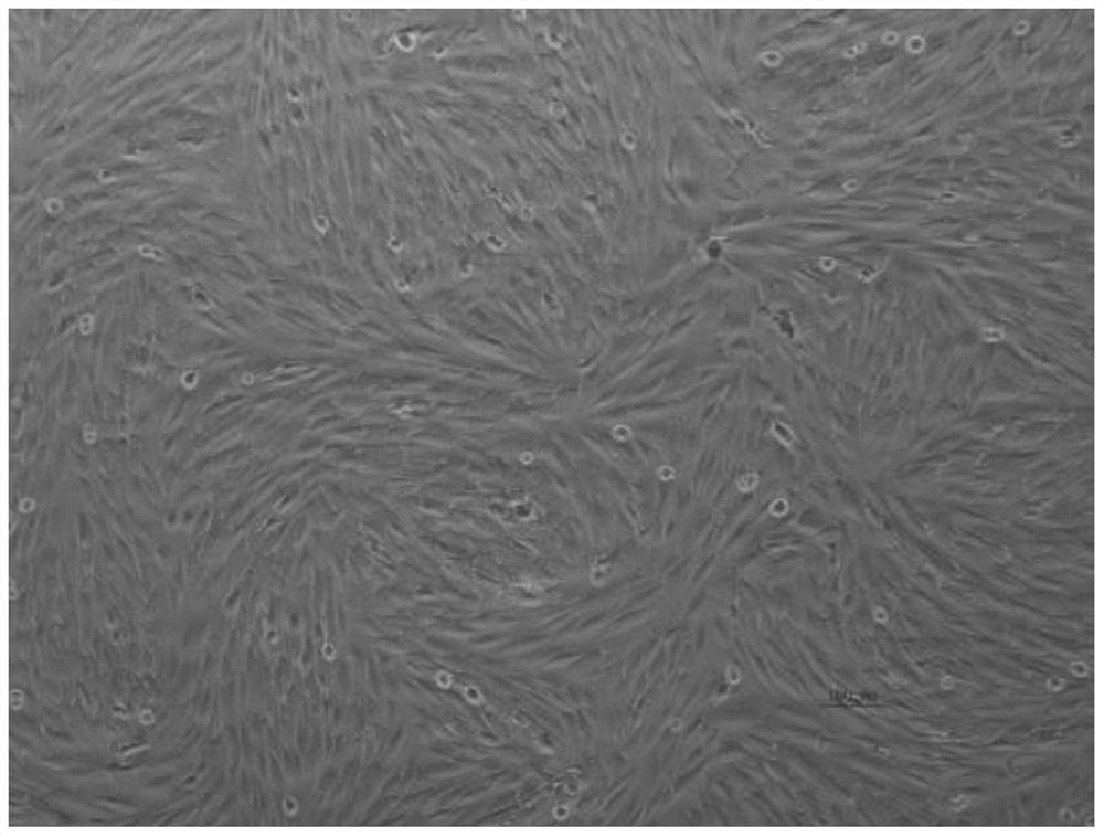 Injectable self-curing artificial bone repair material and preparation method thereof