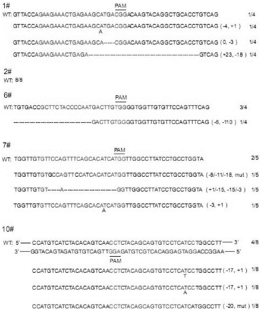 CRISPR/Cas9 recombinant lentiviral vector for human immunodeficiency virus gene therapy and lentivirus of CRISPR/Cas9 recombinant lentiviral vector