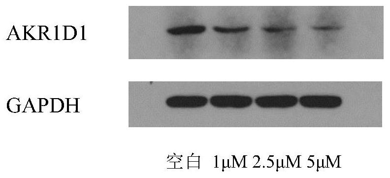 Application of 3-oxo-5 beta-steroid-4-dehydrogenase inhibitor