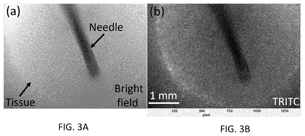 Characterization of injection-induced tissue swelling during subcutaneous injection of biologics