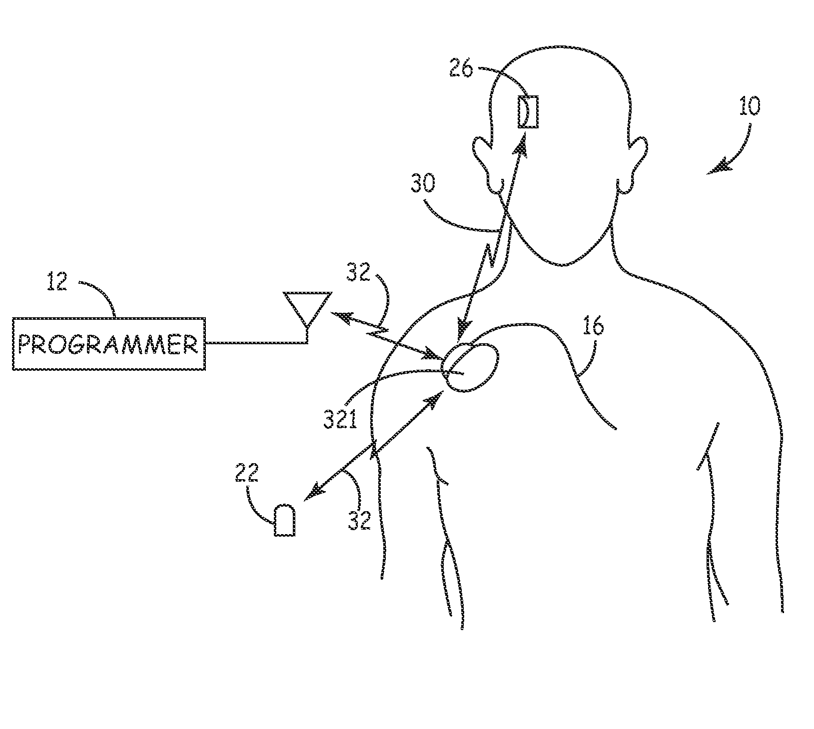 System and method for regulating cardiac triggered therapy to the brain