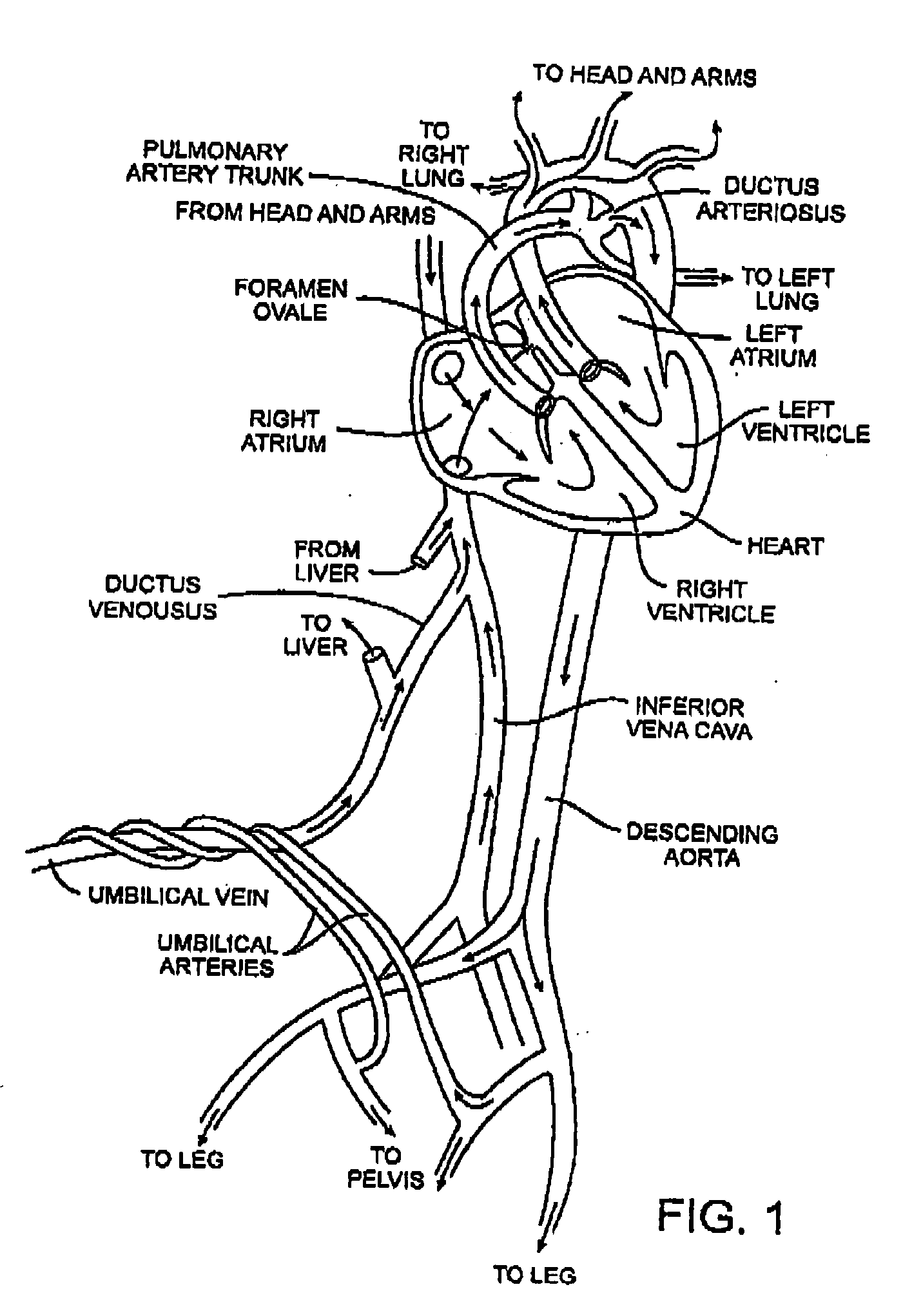 Energy based devices and methods for treatment of anatomic tissue defects