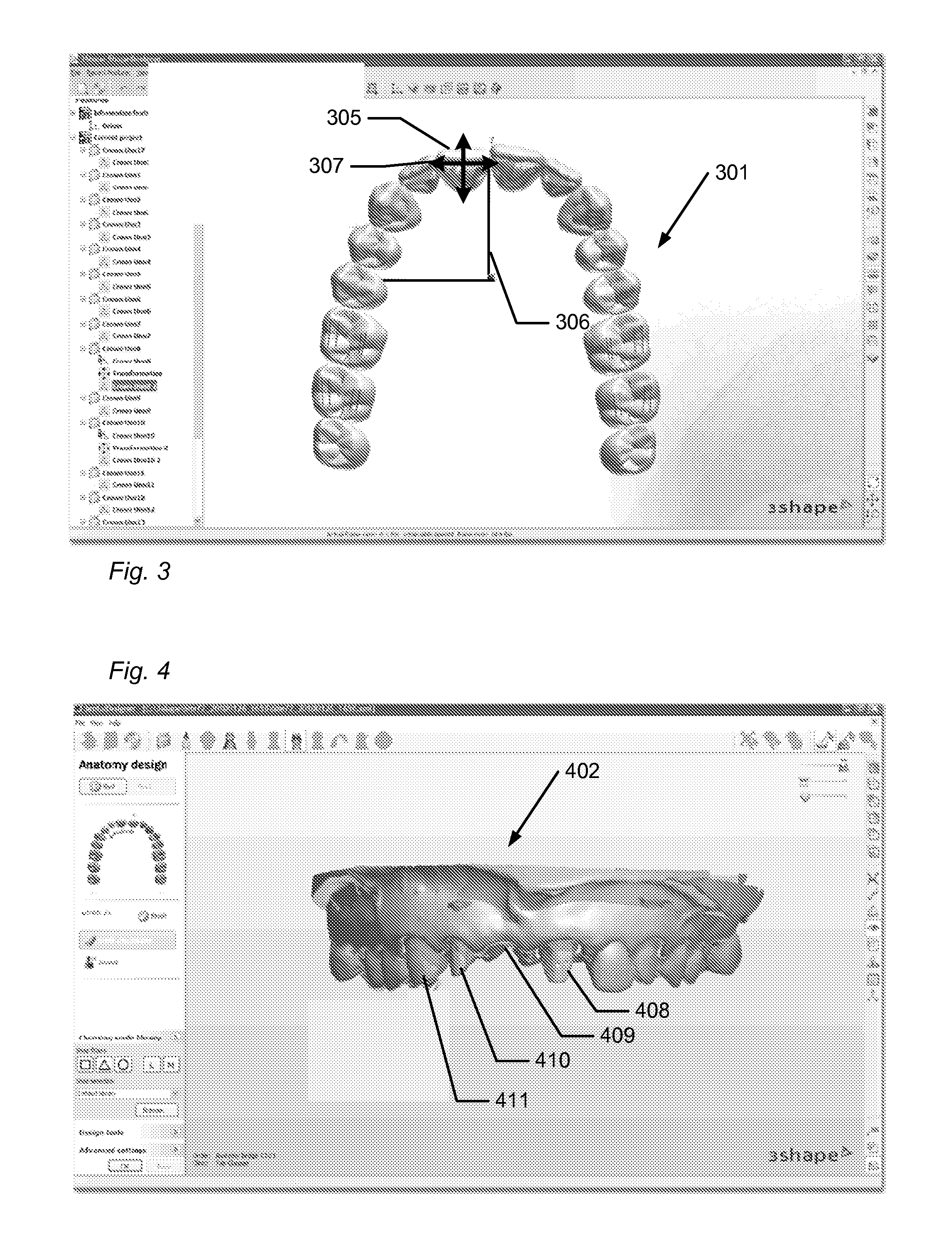 Method of composing and designing a set of teeth