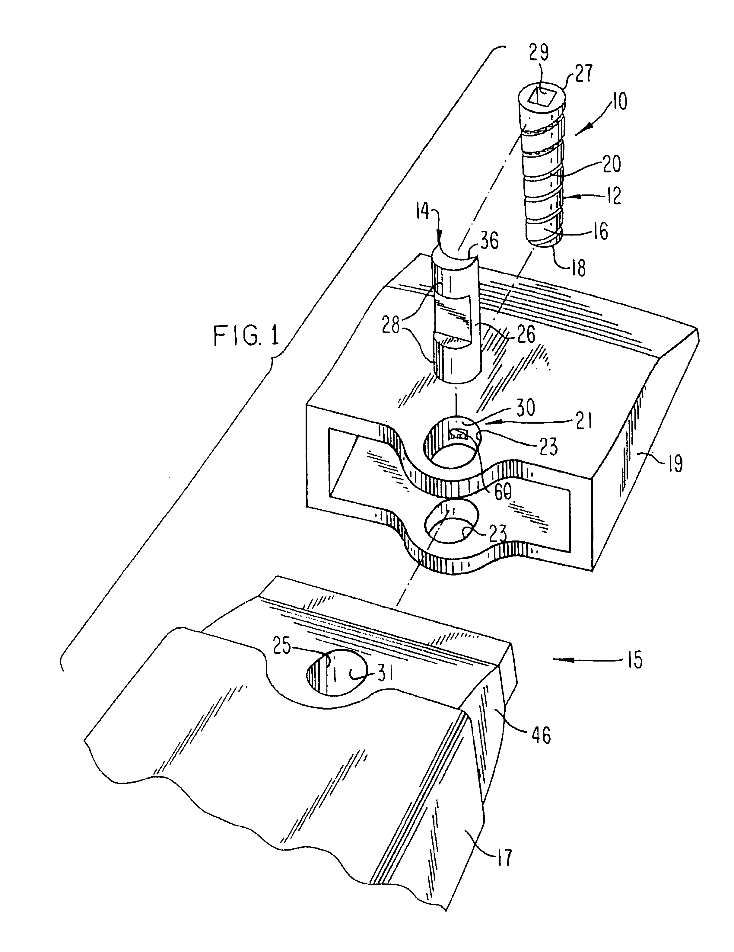 Releasable coupling assembly