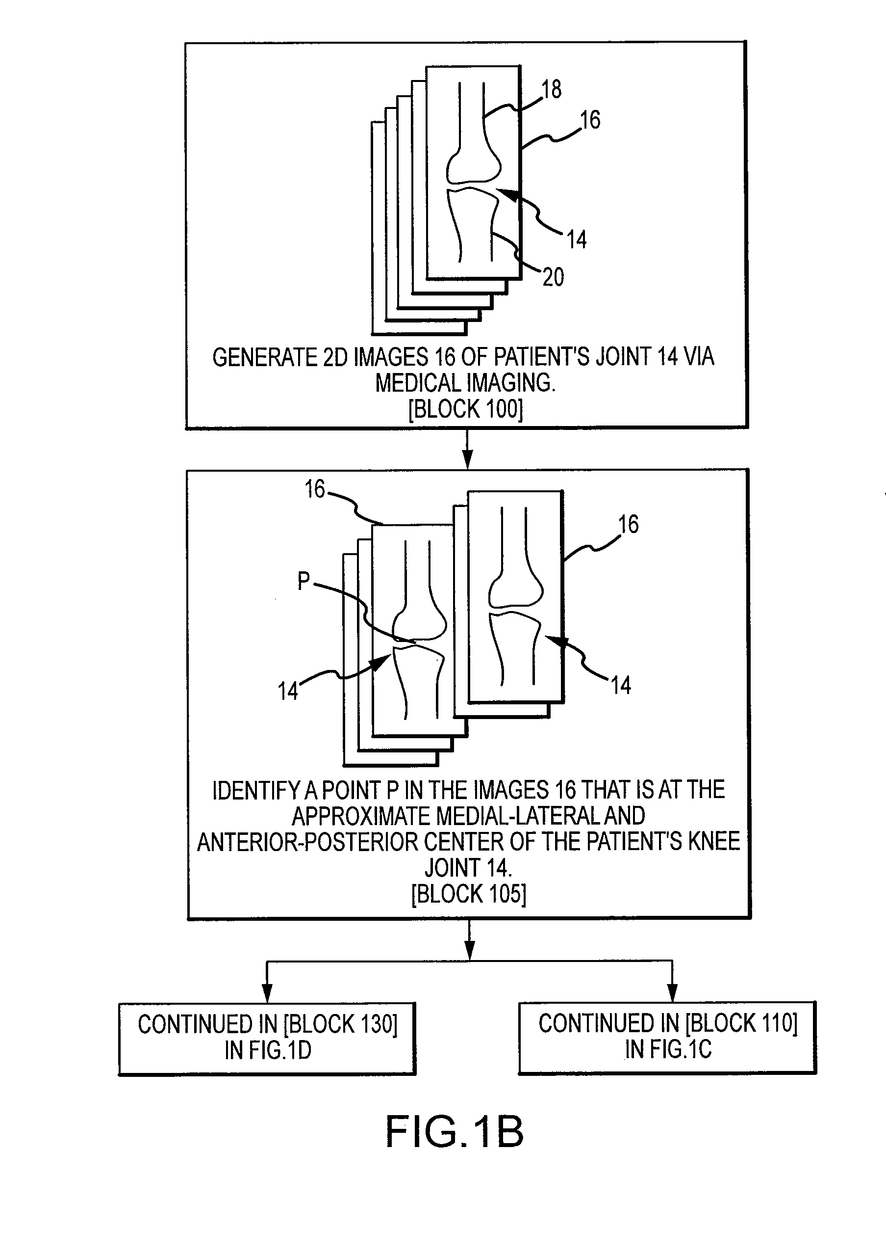 Arthroplasty system and related methods
