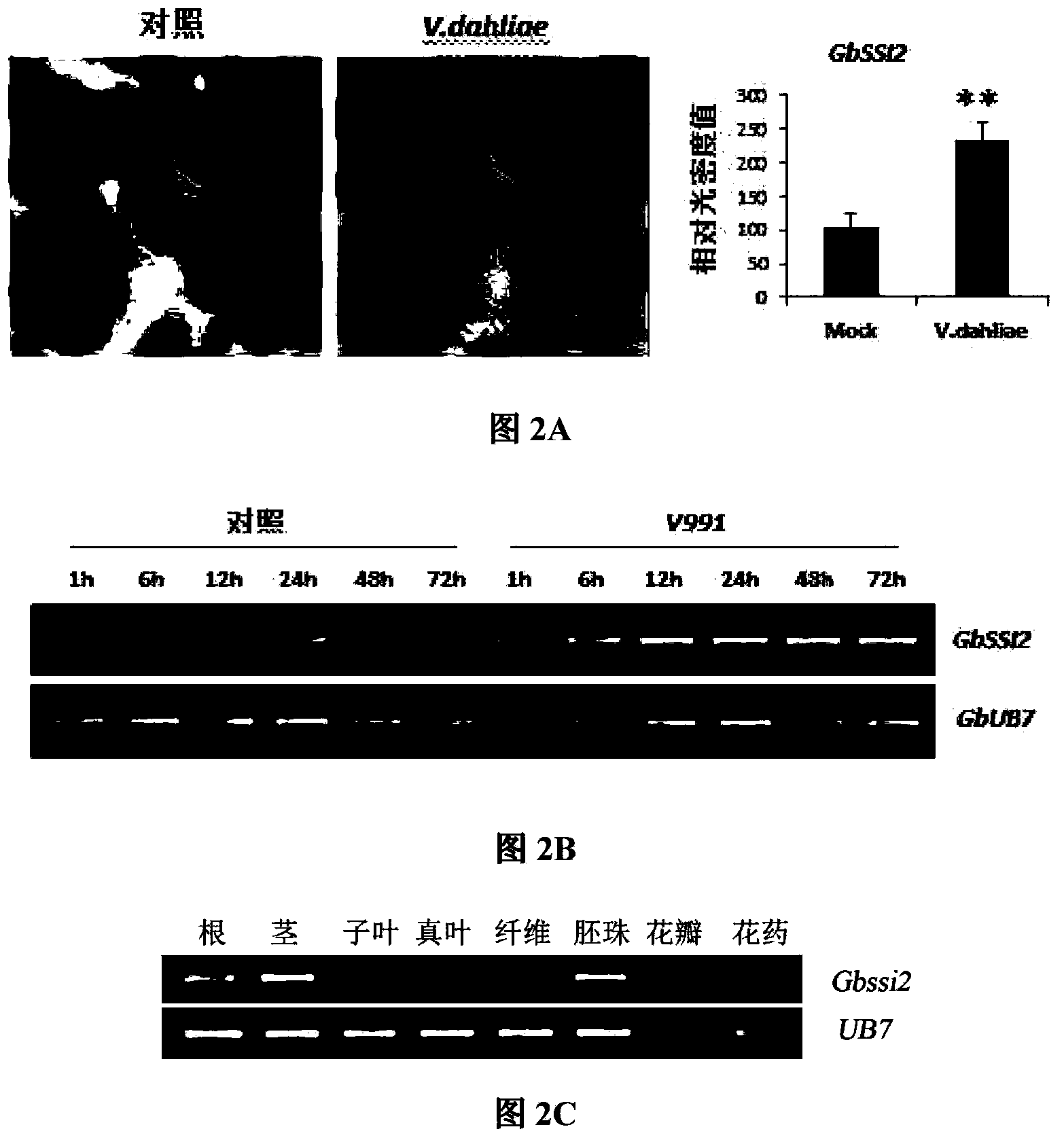 Cotton stearyl desaturase gene GbSSI2 and application thereof