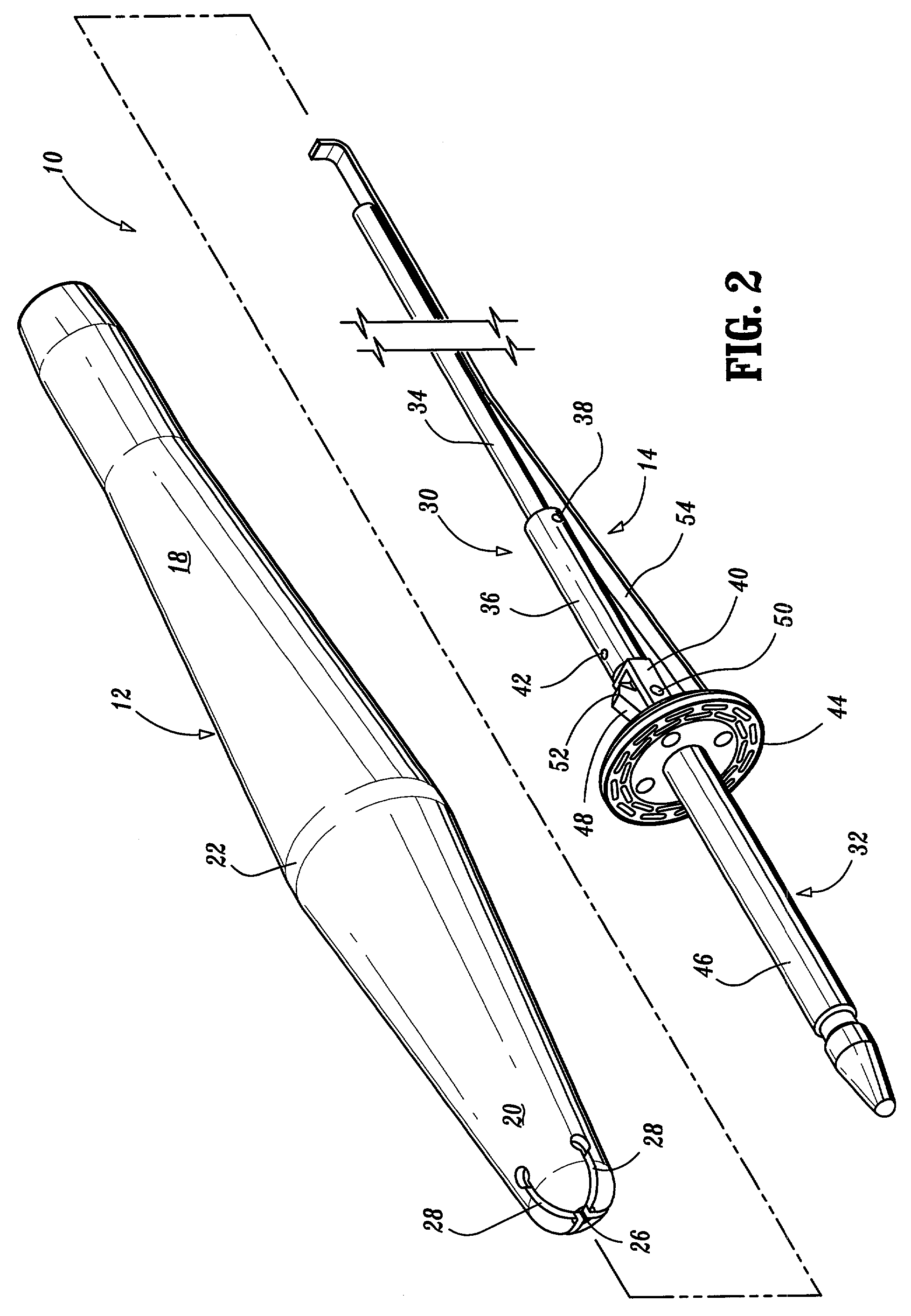 Apparatus and method for performing a bypass procedure in a digestive system