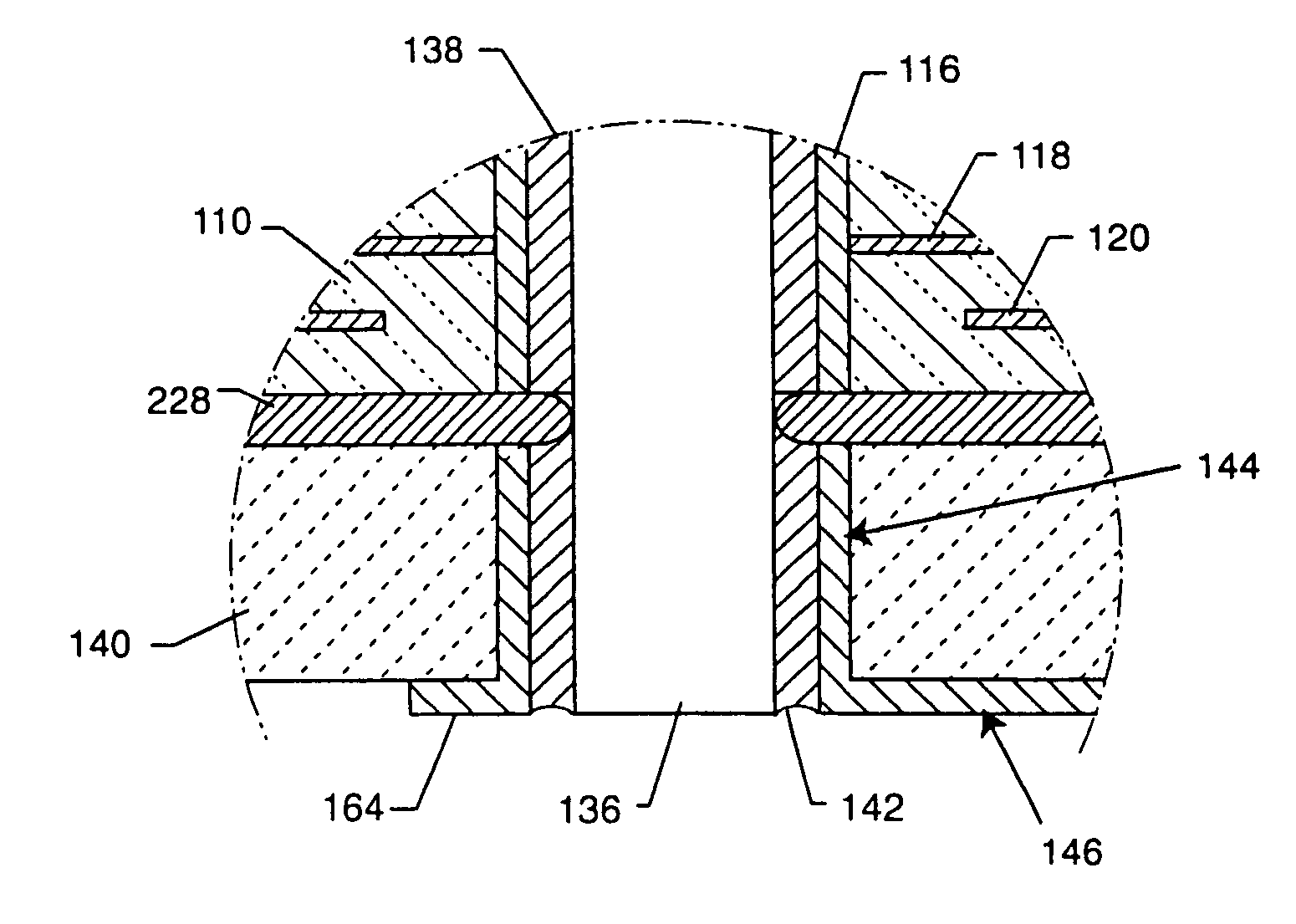 EMI filter terminal assembly with wire bond pads for human implant applications