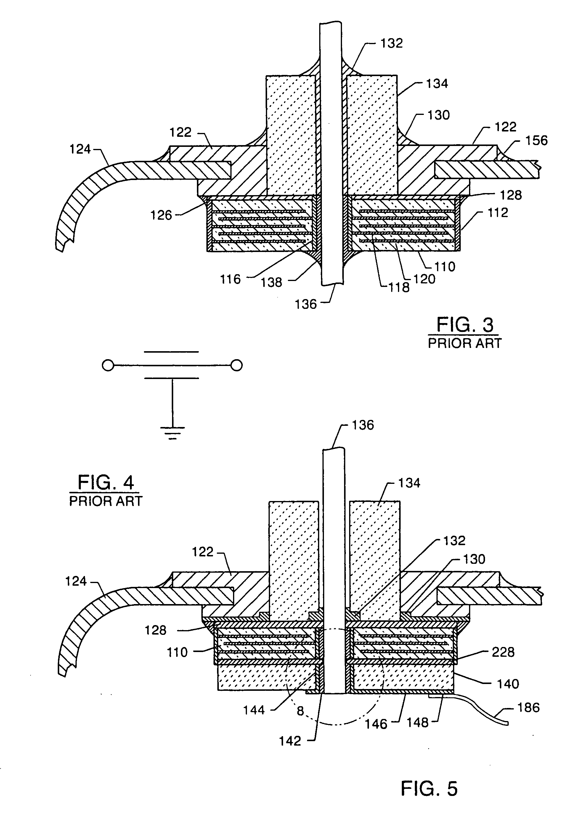 EMI filter terminal assembly with wire bond pads for human implant applications
