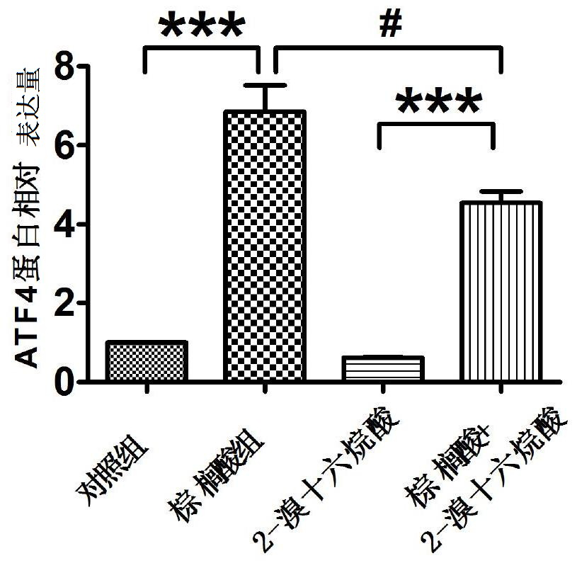 Medicine for preventing and treating metabolic syndrome induced by saturated fatty acid