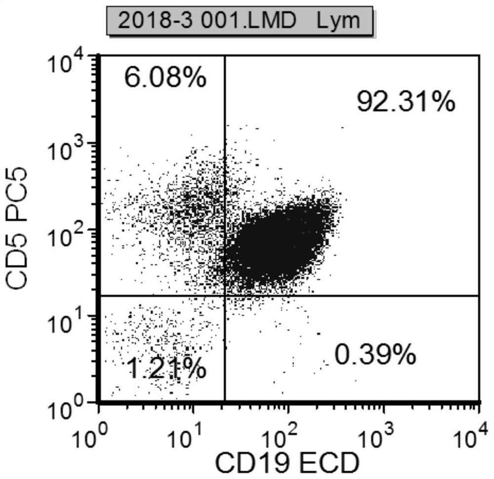 Combined reagent and system for evaluating the prognosis of chronic lymphocytic leukemia