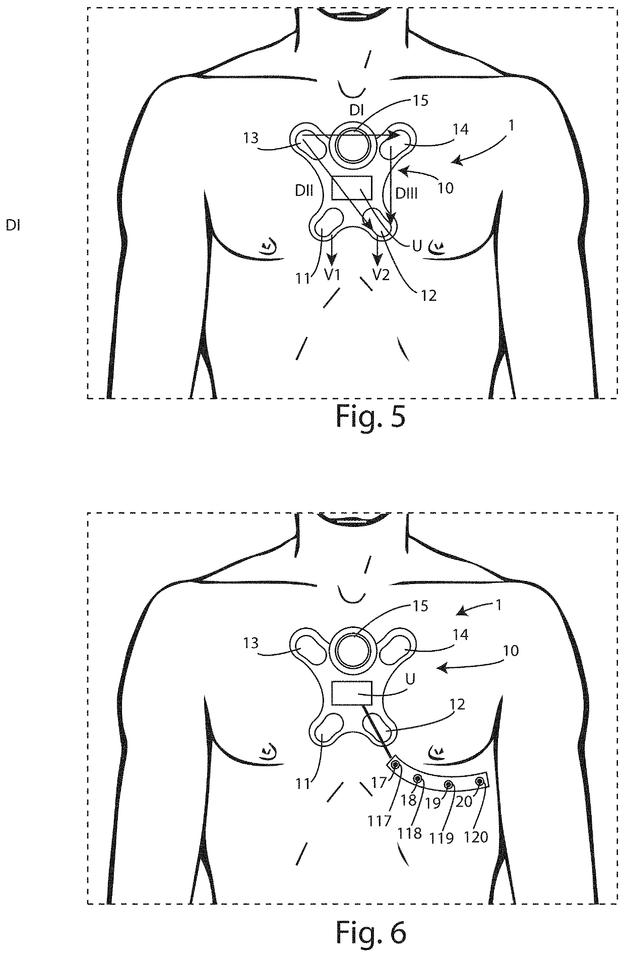 Wearable device for the detection of cardiac signals, a system comprising said device and a relative method of operation