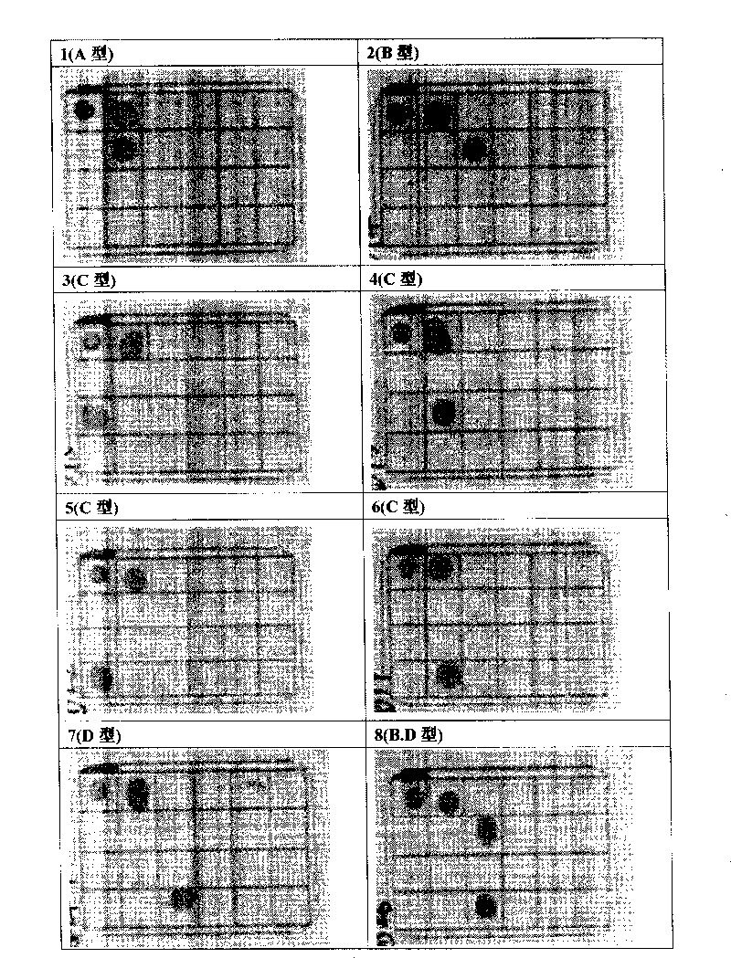 Subtype detection method and reagent kit for hepatitis B virogene