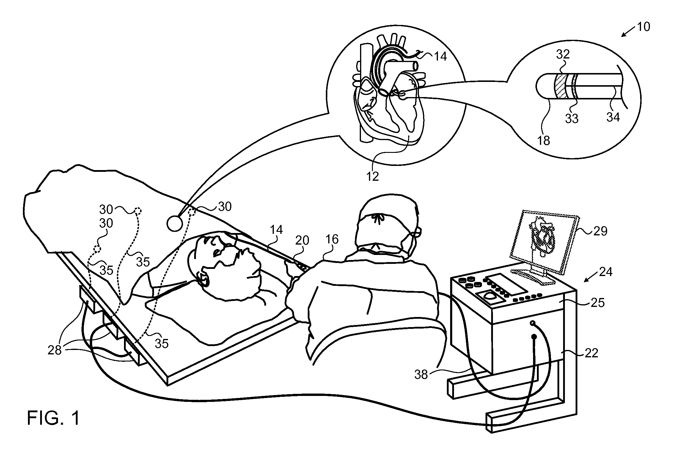 Model based reconstruction of the heart from sparse samples