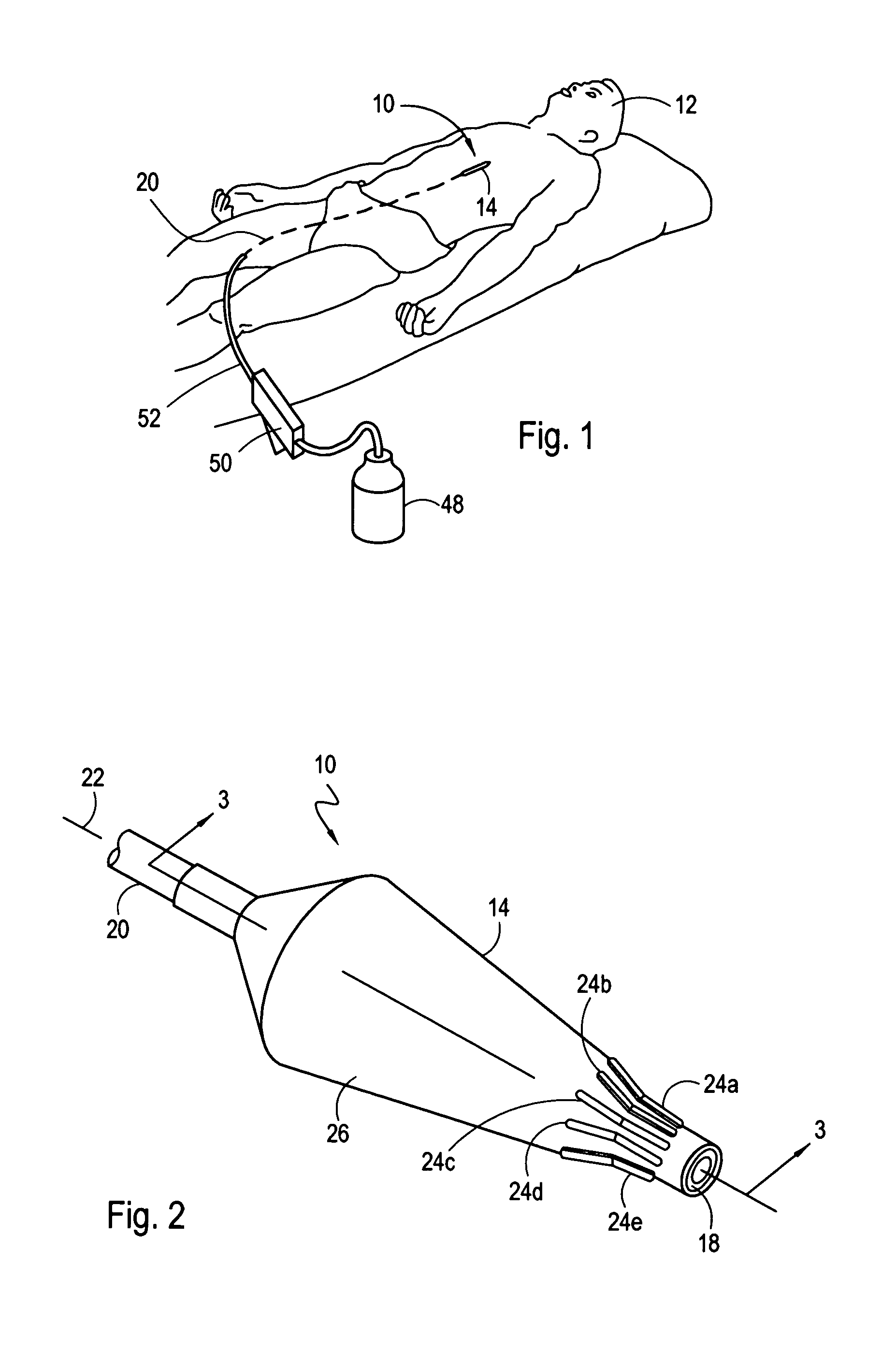 Dilatation catheter with enhanced distal end for crossing occluded lesions