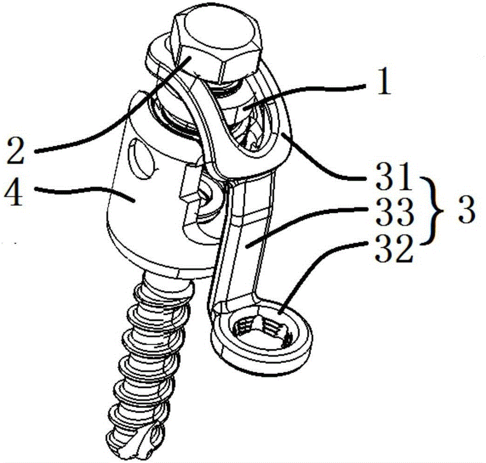 Lateral mass fixing device of pedicle screw