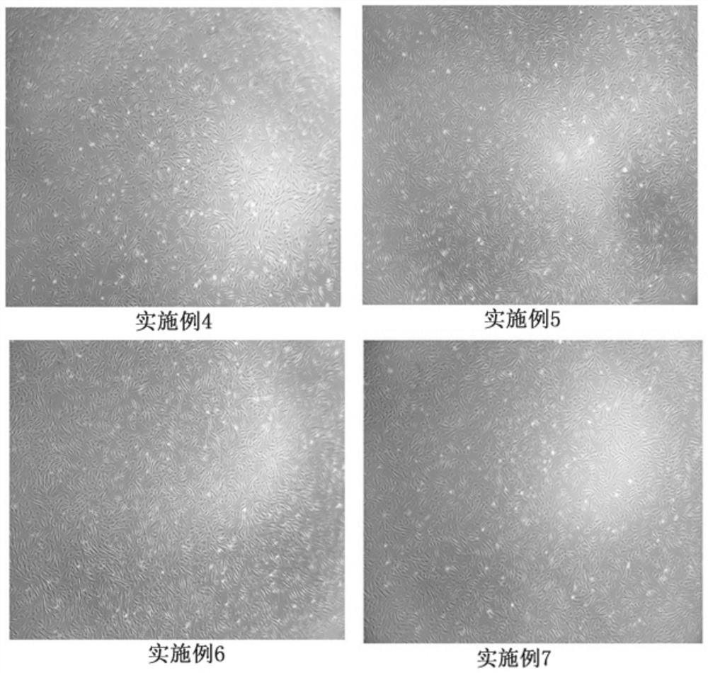 A kind of stem cell cryopreservation liquid and its preparation method and cryopreservation method