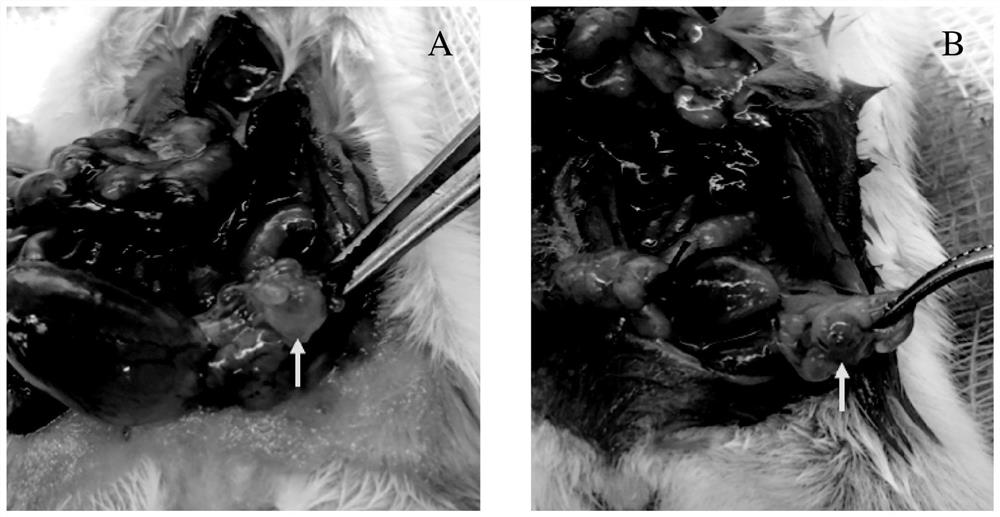 Application of ketorolac to preparation of medicine for preventing or treating postoperative recurrence of endometriosis