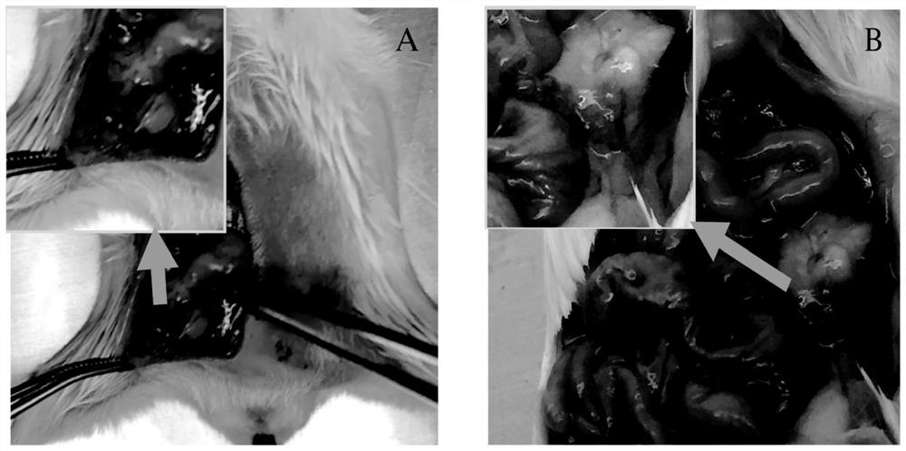 Application of ketorolac to preparation of medicine for preventing or treating postoperative recurrence of endometriosis