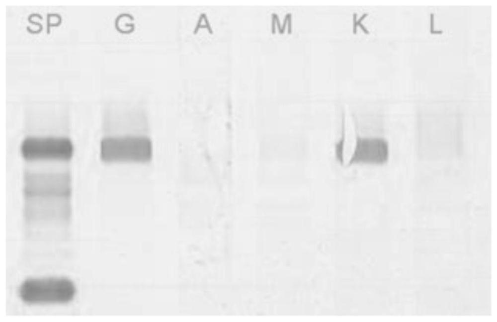 A method for automatic classification of immunofixation electropherograms based on their extracted features