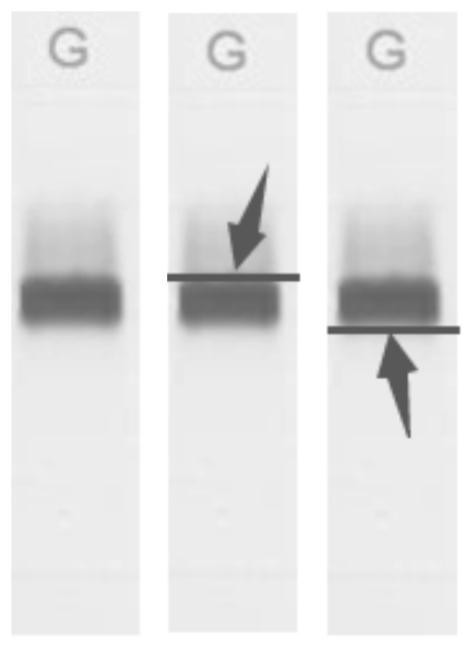 A method for automatic classification of immunofixation electropherograms based on their extracted features