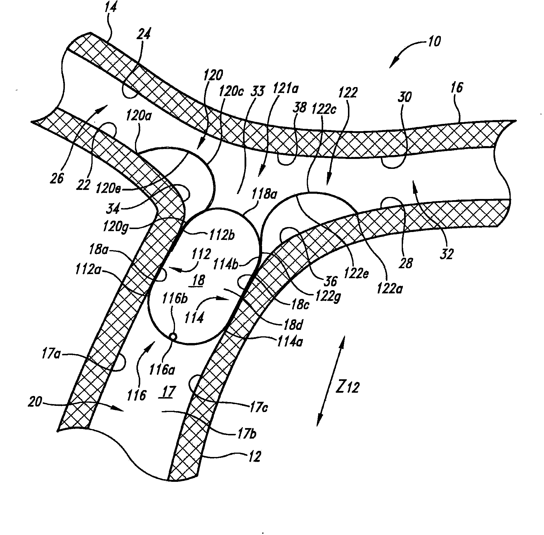 Vascular anchor positioning system and method