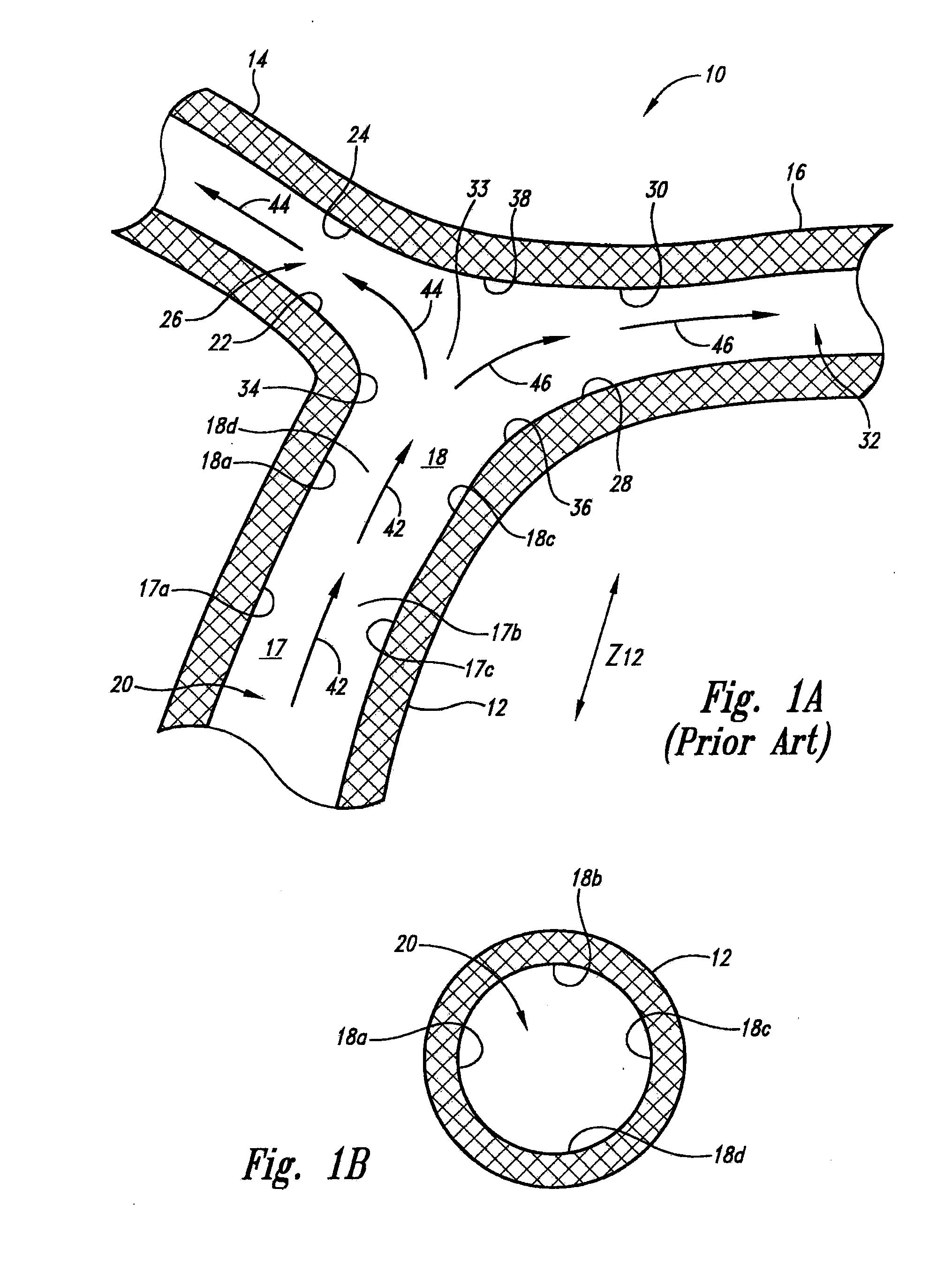 Vascular anchor positioning system and method