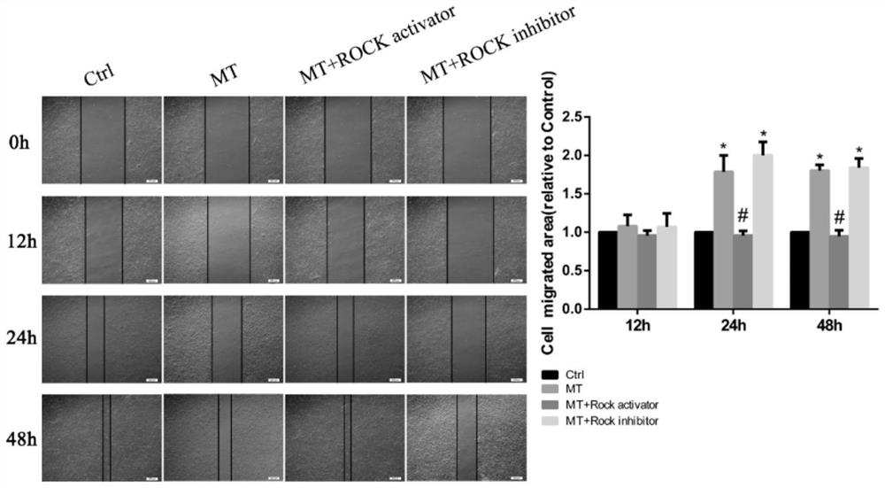 Application of melatonin in the preparation of medicaments for the treatment and adjuvant treatment of osteosarcoma