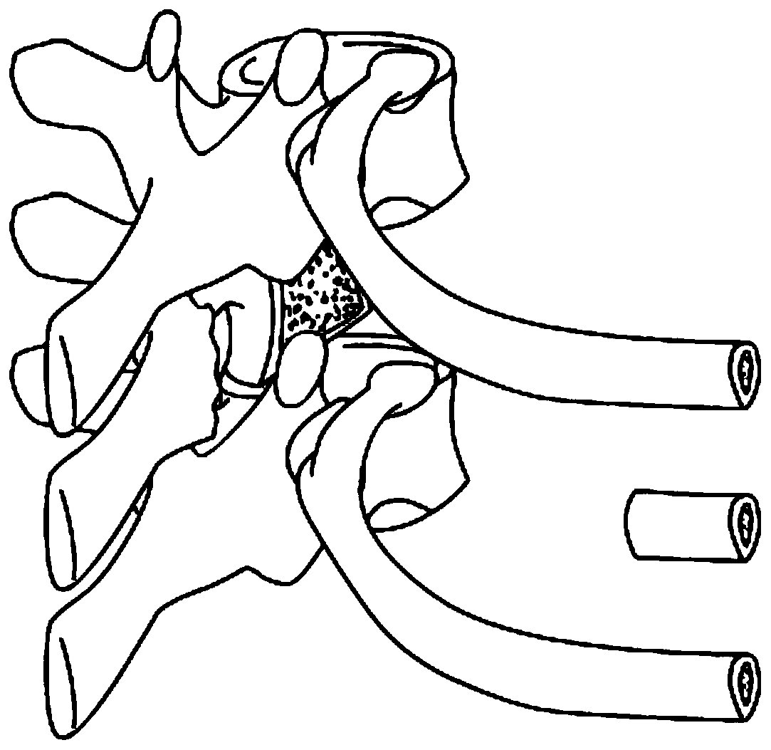 Costovertebral joint and reconstruction method thereof