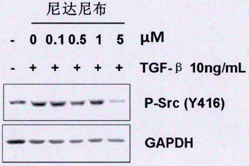 Application of nintedanib in preparing medicament for preventing and treating liver fibrosis and hepatocirrhosis