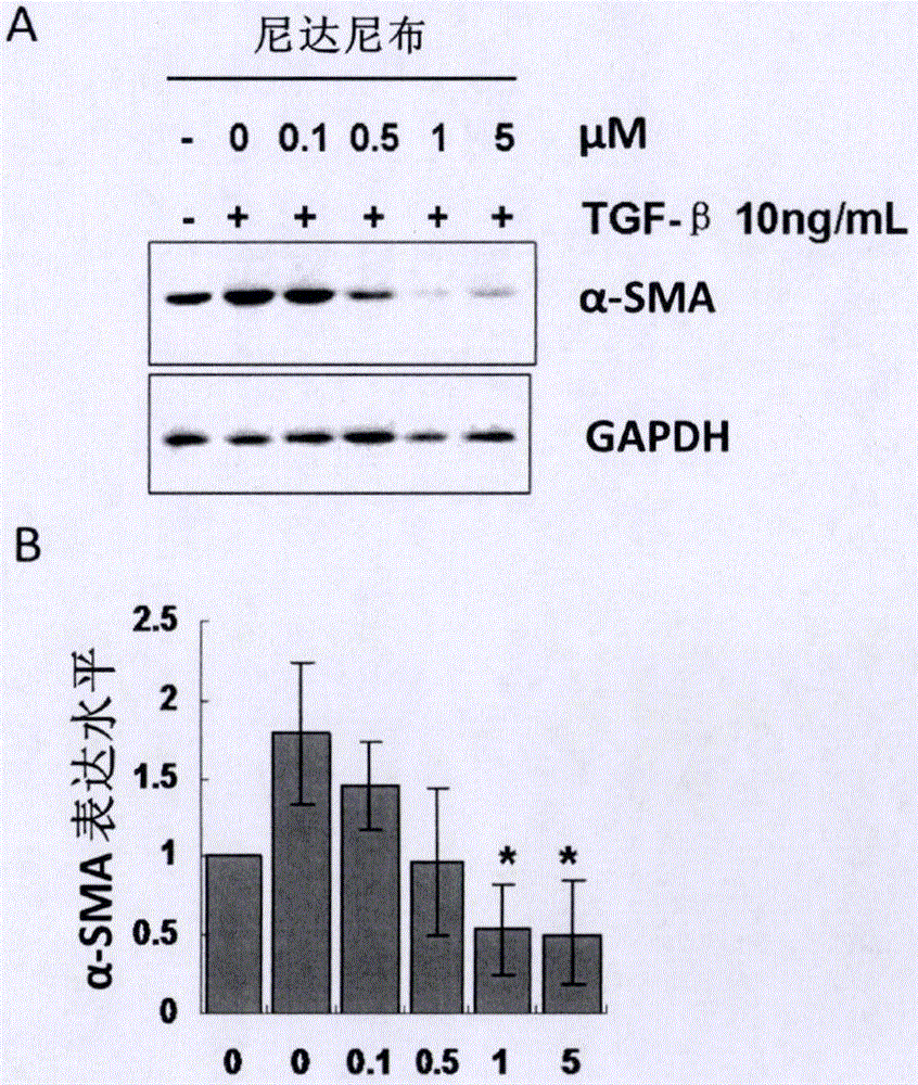 Application of nintedanib in preparing medicament for preventing and treating liver fibrosis and hepatocirrhosis