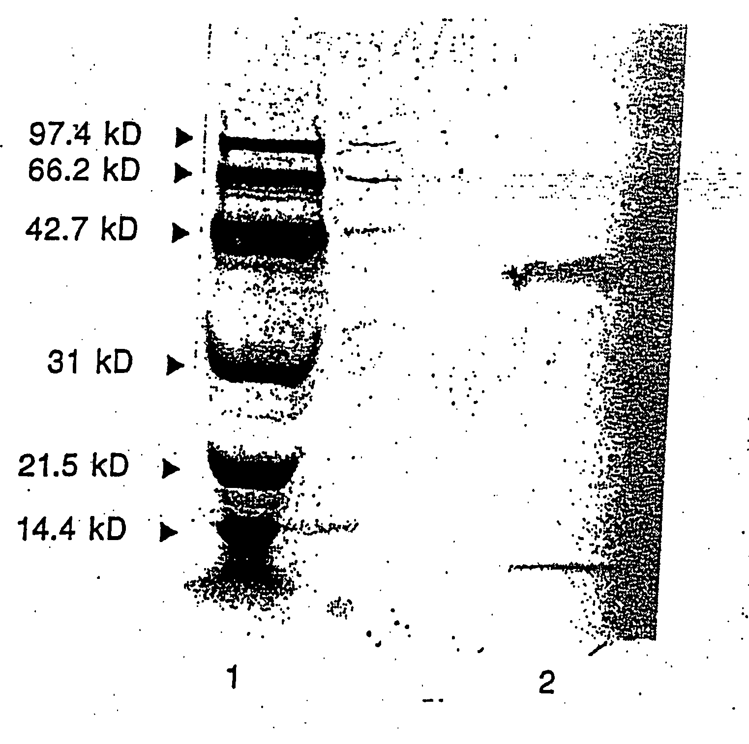 Therapeutic uses of glandular kallikrein