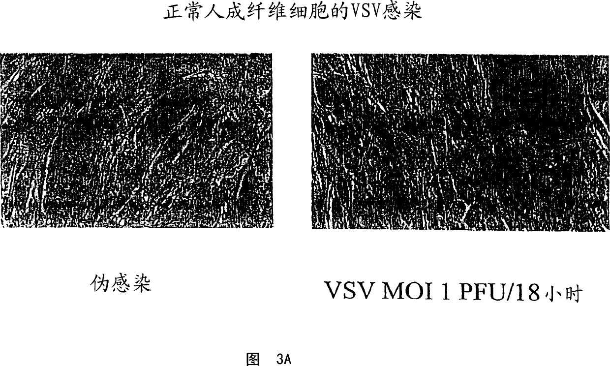 Vesicular stromatitis virus (VSV)