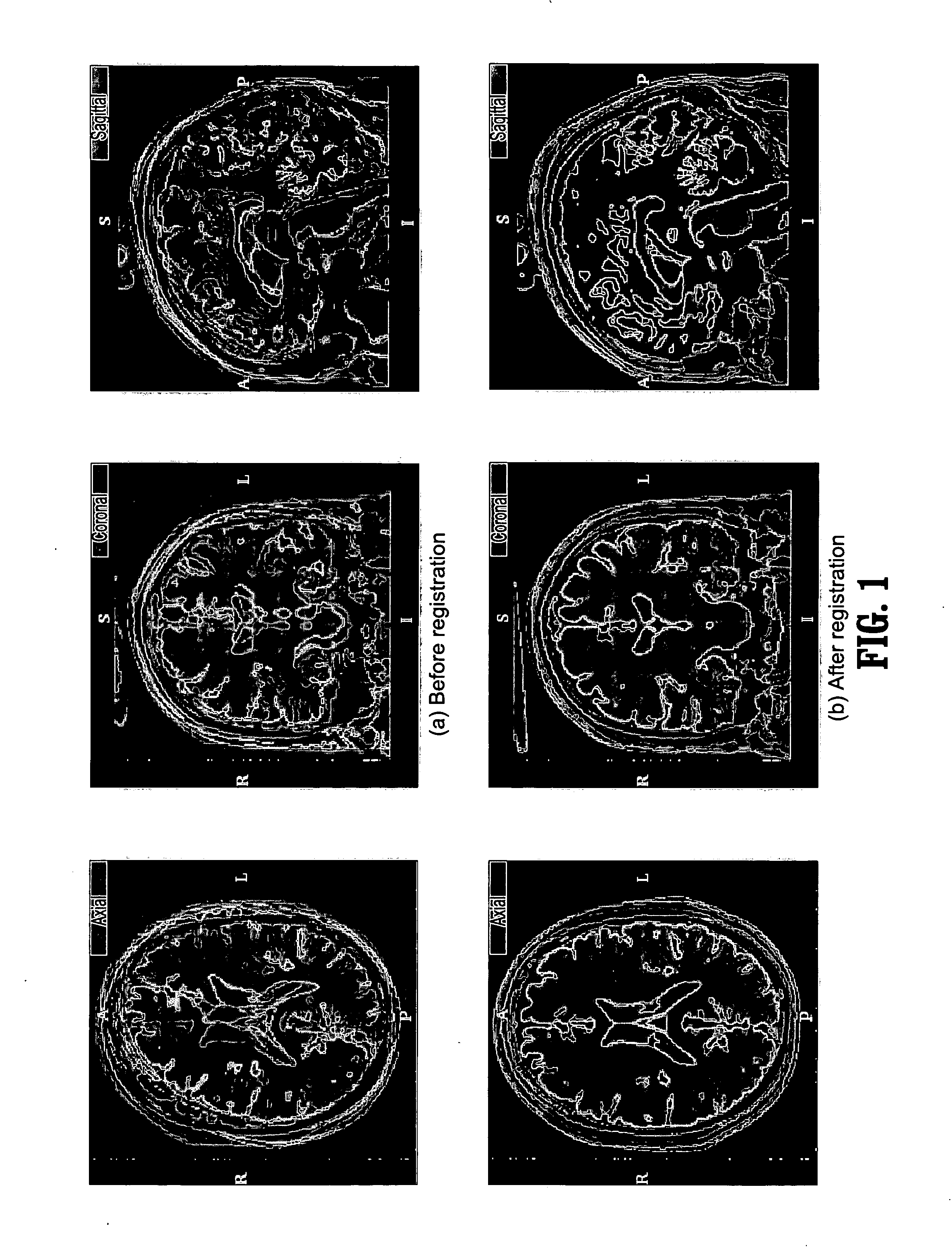 System and method for fast multimodal registration by least squares