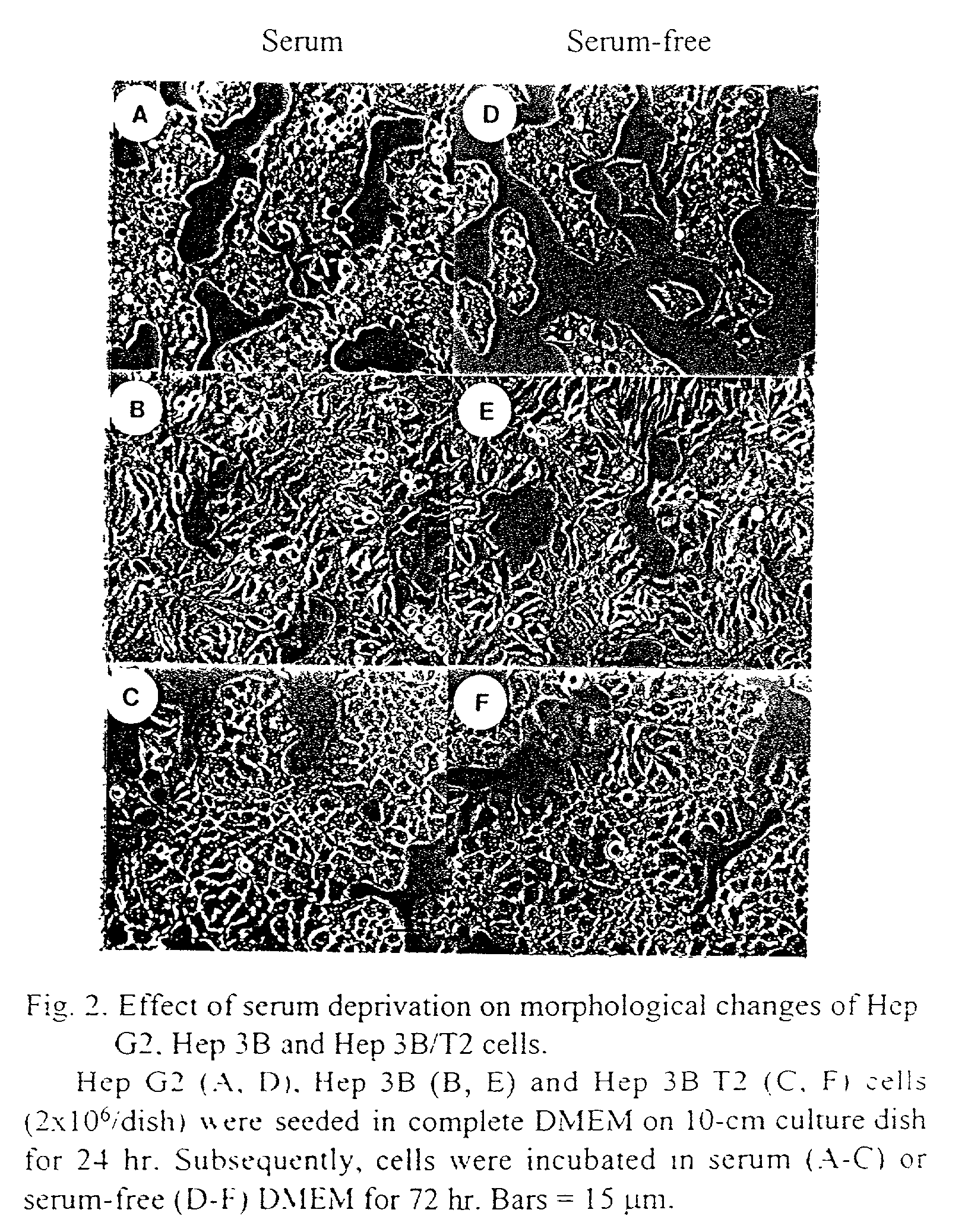 Method for sensitizing cancer cells to cancer therapies with a mevalonate-reducing compound