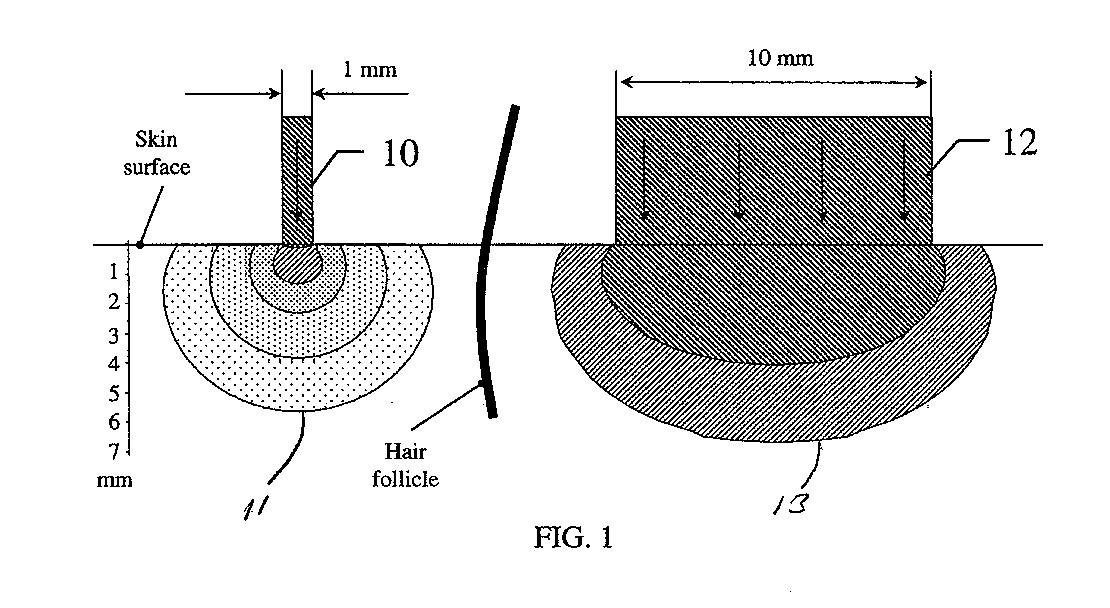 Method and apparatus of treating tissue