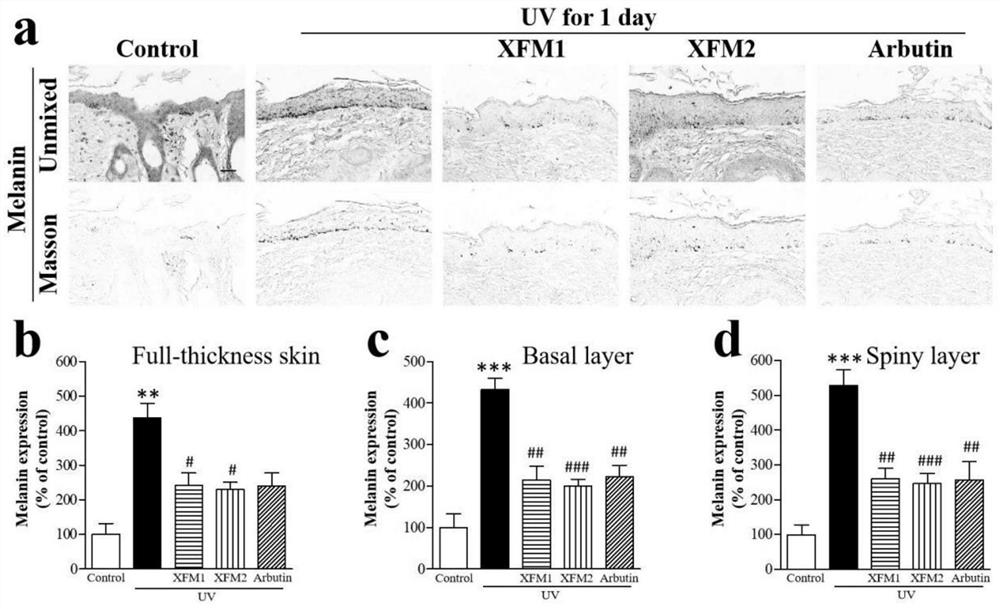 A kind of whitening and freckle-removing essence for external use to treat skin pigmentation and its preparation method and application