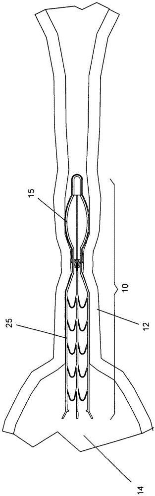 Lumen occluding device, delivery catheter and method