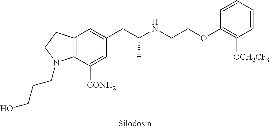 Silodosin Intermediate and Preparation Method Therefor