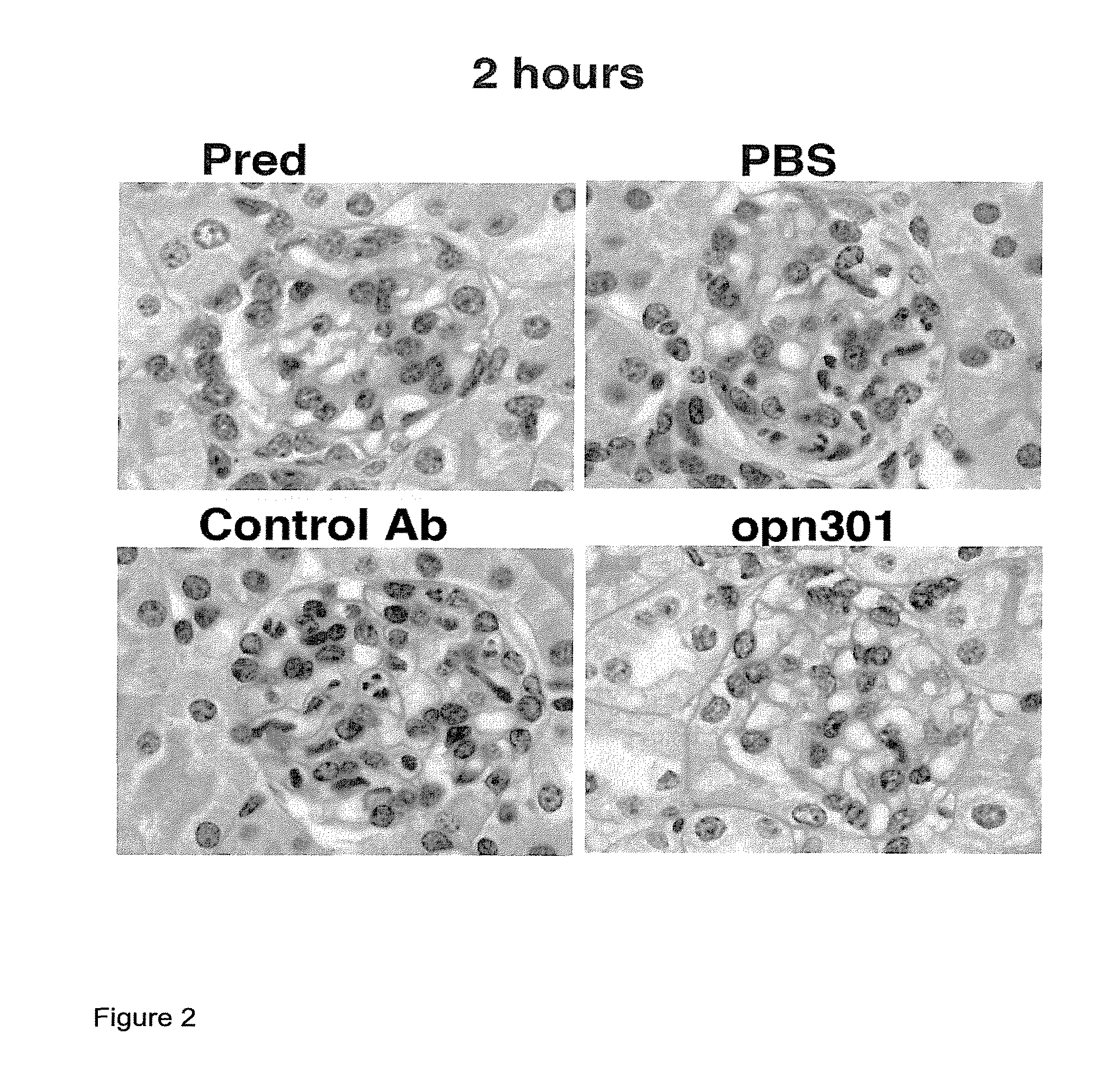 Compounds and methods for the treatment of renal disease